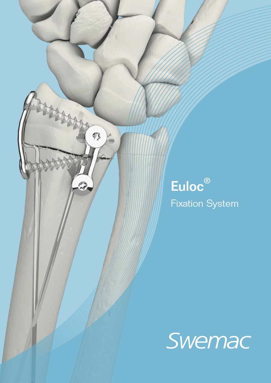 0011_Euloc Fixation System - P135-28-20201202